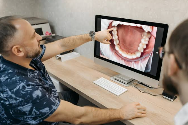5 Questions To Ask About Your Dental X Rays